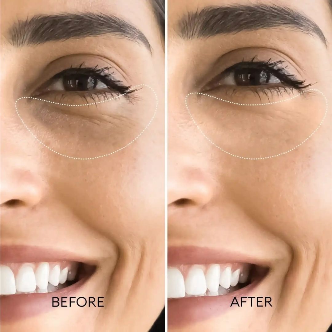 HoneyBae Instant Eye Fix Cream