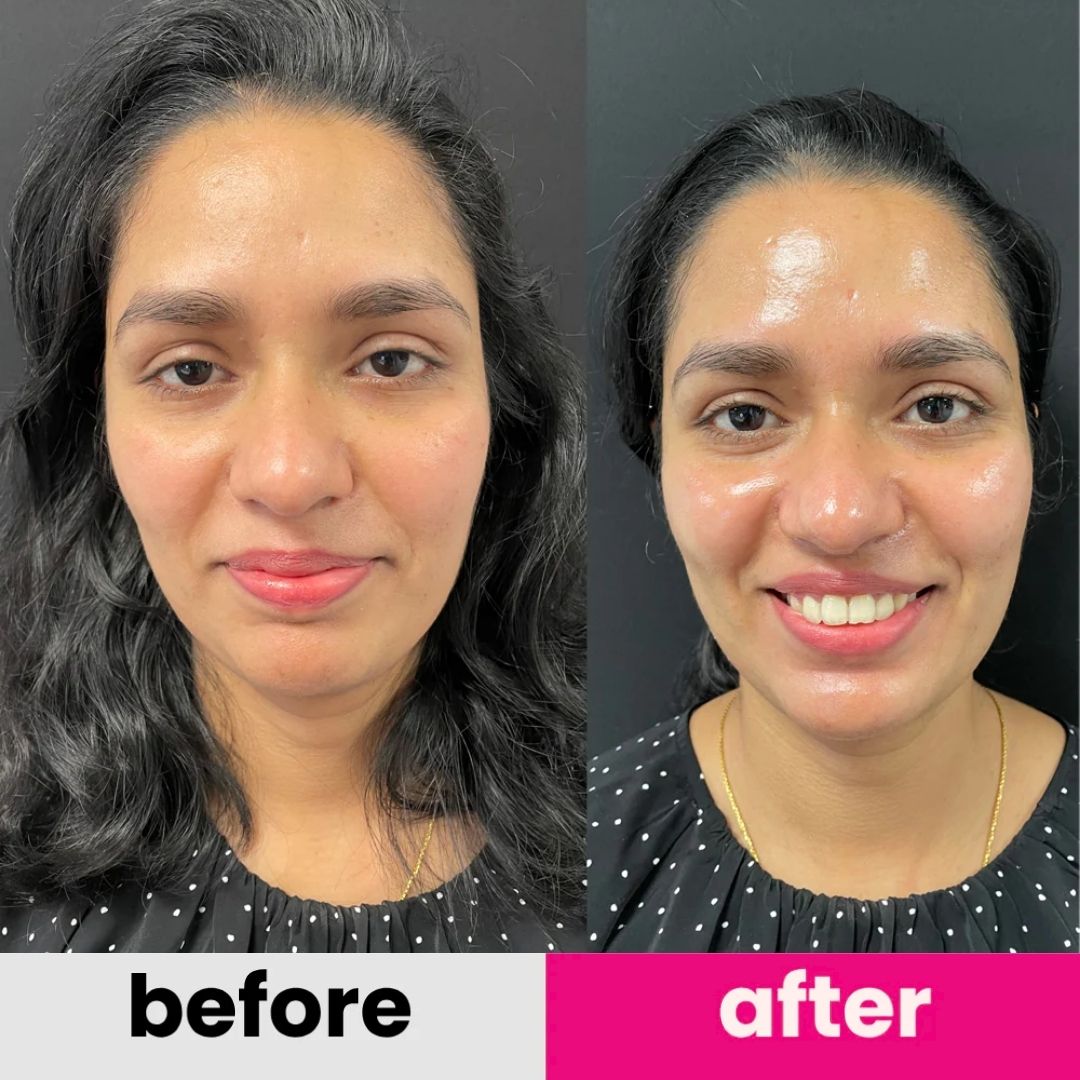 T3 Baby Collagen Face Mask