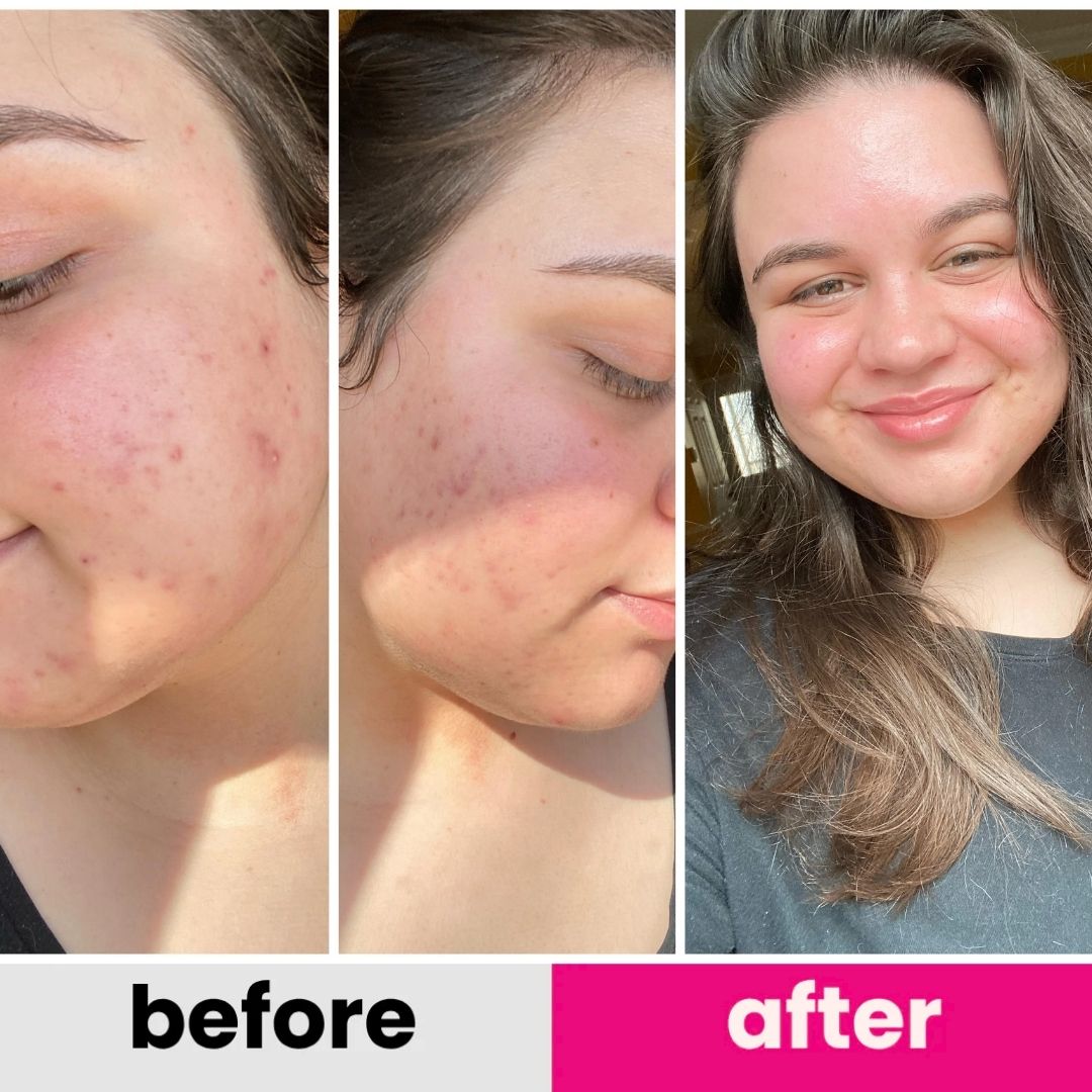 T3 Baby Collagen Face Mask