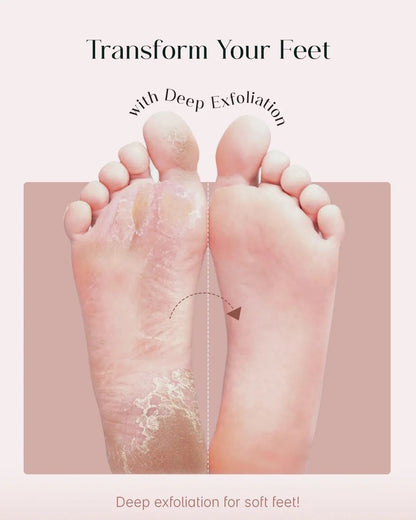 Foot Exfoliating & Peeling Mask
