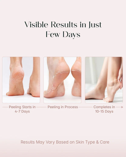 Foot Exfoliating & Peeling Mask